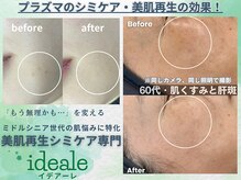 イデアーレ(ideale)