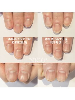 ニコプラス(NICO+)/ジェルネイルができない方向け