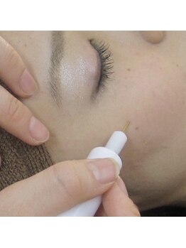 エンルーチェ(enluce)/【天六・梅田】シミケア