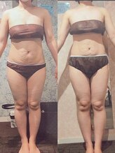 パーフェクトボディプレミアム 札幌駅前店(PERFECT BODY PREMIUM)/お客様　ビフォーアフター（5）