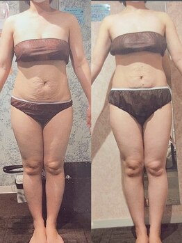 パーフェクトボディプレミアム 札幌駅前店(PERFECT BODY PREMIUM)/お客様　ビフォーアフター（5）