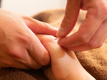 伝統鍼灸喜心堂の写真/専門知識に基づいた鍼灸施術/丁寧なカウンセリングと施術であなたの“今”に合ったケアを行います