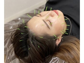 ハリルル 併設 GLケンタ鍼灸整骨院(HARILULU)/美髪効果も！ヘッドHARI