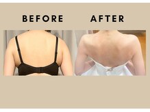 バウト(VAUT)/before/after