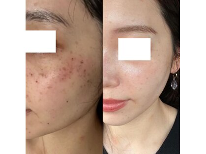 アンド ユー(and.yu)の写真