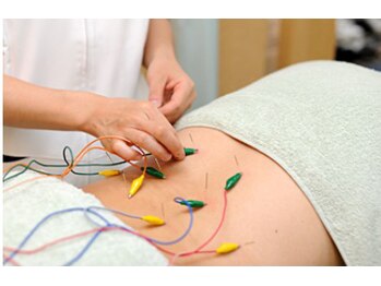 よし鍼灸接骨院 南堀江院/鍼施術