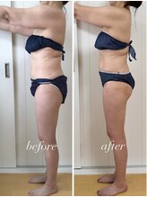 バニスティ 鶴岡店/全身痩身エステでスッキリ