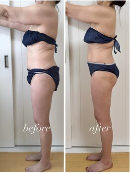 バニスティ 鶴岡店/全身痩身エステでスッキリ