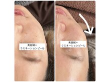 陽月 鍼灸院整骨院/小顔もツヤ肌も◎