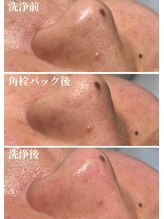 ビーラボ(Be-Lab.)/日々の洗顔で落ちない汚れ…