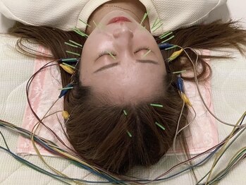 フジ鍼療所の写真/【美容鍼で肌改善！】デスクワーク/家事/育児で溜まった疲れを癒したい方に◎悩みに合わせた施術をご提案☆