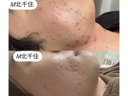 M 北千住店(の写真