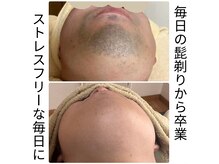 脱毛サロン ティアレ(Tiare)