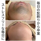 脱毛サロン ティアレ(Tiare)