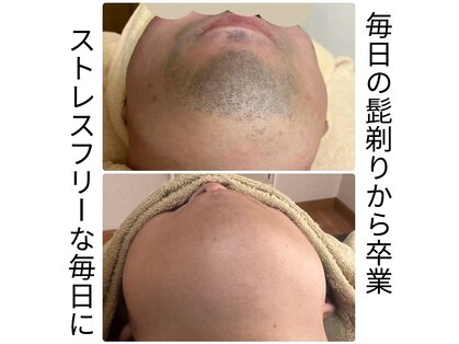 脱毛サロン ティアレ(Tiare)の写真