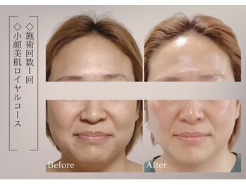 ベラ 東京院(Bella)/高実感が叶う秘密は看護師施術♪