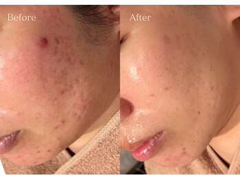 シューラディアント(ShuRadiant)/エンビロン正規取扱店