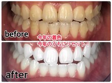 【気になる黄ばみ、今こそリセット】
