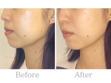 ブルースター/横顔がさらに美しく＊