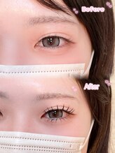 アテプラス(ate+)/上下エクステ