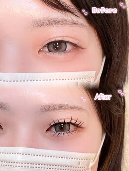 アテプラス(ate+)/上下エクステ