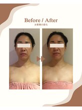 ビーキュート 学芸大学店(BE-CUTE)/Before/After　施術