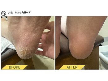ふっとけ庵/足裏角質ケア