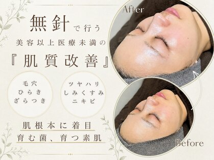 フロラスキン 恵比寿Amour店(florasKIN)の写真