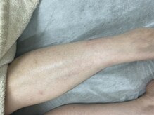 ナノハナ/鹿沼市全身脱毛美容室ナノハナ