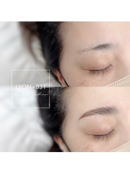 リヨン(LYON+831)/