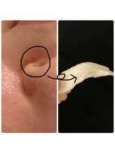 ビューティーライフ(beauty life)/フェイシャルWAX