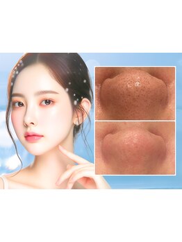 毛穴ケアをしたい