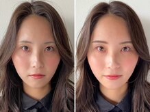 可愛さUP◎お客様施術Before＆After