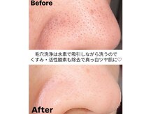 スーリール(SOURIRE)の雰囲気（種類豊富なマシンと熟練のハンドでお悩みに多角的にアプローチ☆）