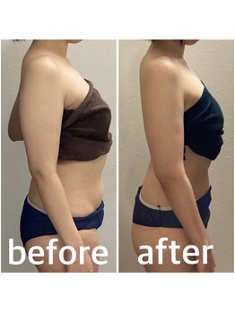 アイズ 横浜店(ize)/