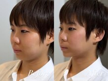 ハクト(Hakuto)/Before/After