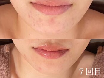 ホワイトアクア 四日市店(WHITE AQUA)/圧倒的結果重視