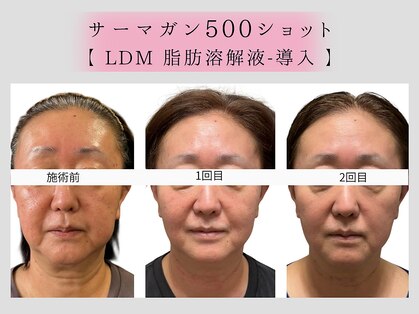 シャムリー(SHAMRY)の写真