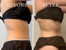 ヨサパーク ニコナ 三軒茶屋南口(YOSA PARK nicona)/ブライダル前ダイエット