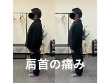 カワル整体 長嶺院/ストレートネック