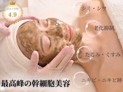 ブリス(Bliss)の写真