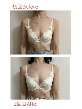 チュラ 大宮店(Chura)/【50代】バストアップ2回目@大宮