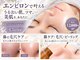 クラリス(Clarice)の写真