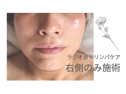 フロラリラ(Florarela)の写真