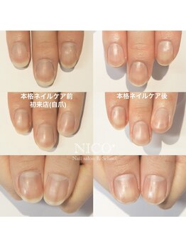 ニコプラス(NICO+)/ジェルネイルができない方向け