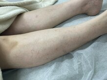 ナノハナ/鹿沼市全身脱毛美容室ナノハナ