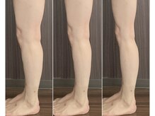 バーテックスキー(Vertexkey)/ごっつい脚の変化