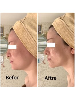 スペチアーレ 夙川/小顔＆目元パッチリ