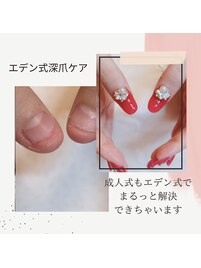深爪直して成人式ネイル