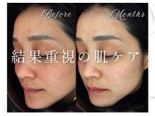 ビーホワイト(BeWhite)